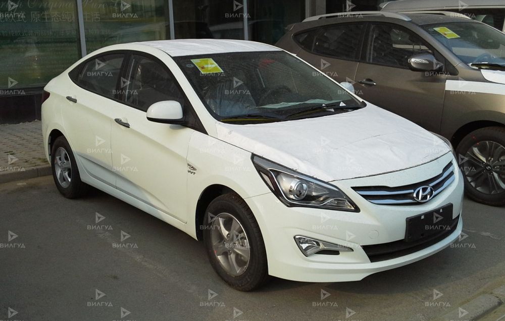 Замена датчика положения дроссельной заслонки Hyundai Verna