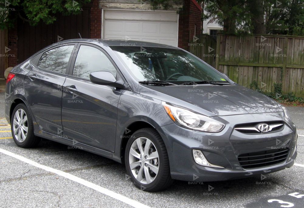 Ремонт вариатора Hyundai Accent